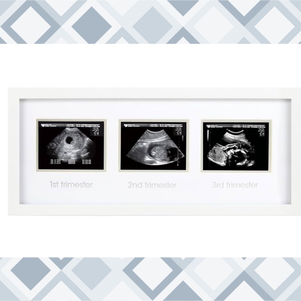 Sonogram 3 Trimester Picture Frame - White